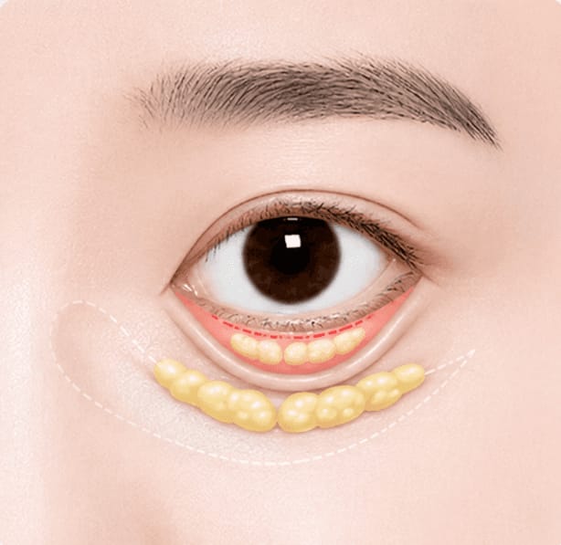 재배치