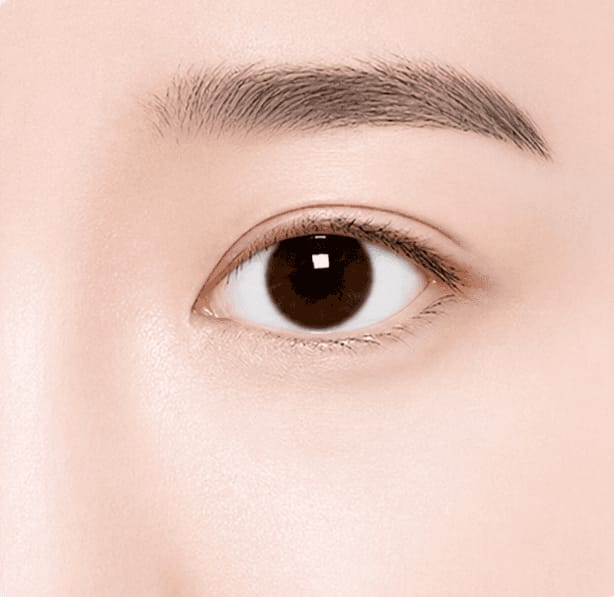 흉터