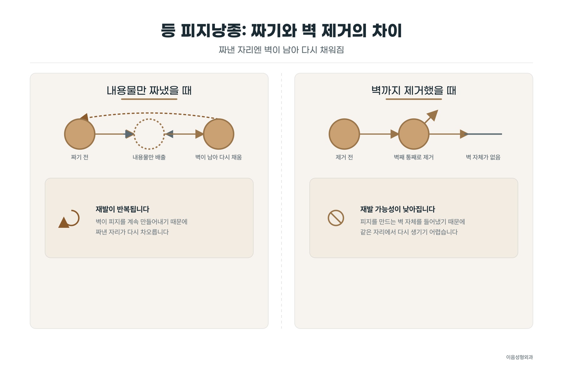 짜기와 벽 제거의 차이
