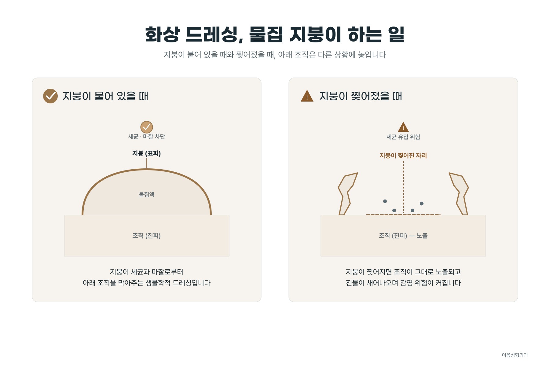 물집의 지붕이 아래 조직을 덮고 있는 단면