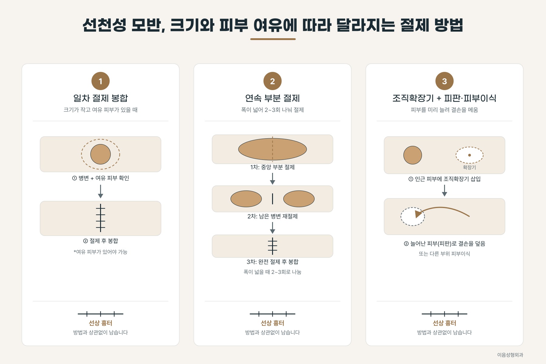 병변 크기와 주변 피부 여유에 따라 달라지는 절제 방법