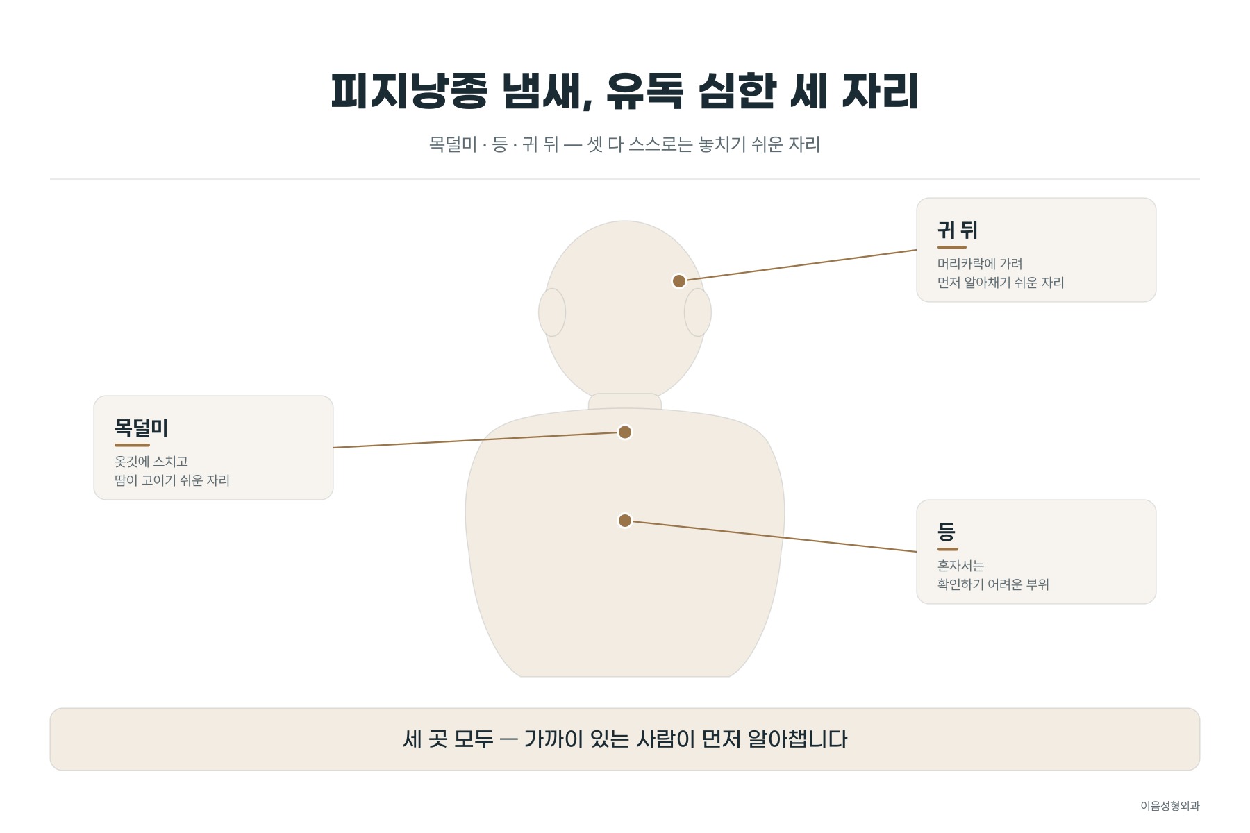 피지낭종이 잘 생기고 냄새가 특히 신경 쓰이는 부위 — 목덜미, 등, 귀 뒤