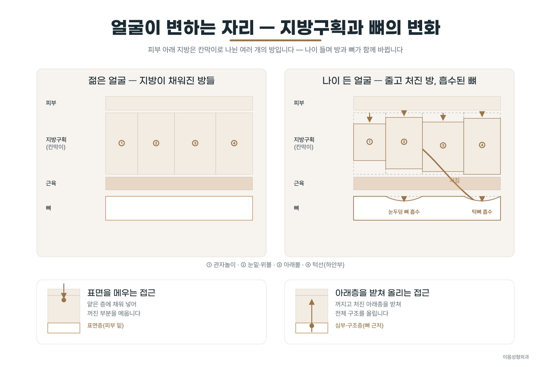 나이 들며 얼굴이 변하는 자리 — 지방구획 감소와 처짐, 뼈 흡수
