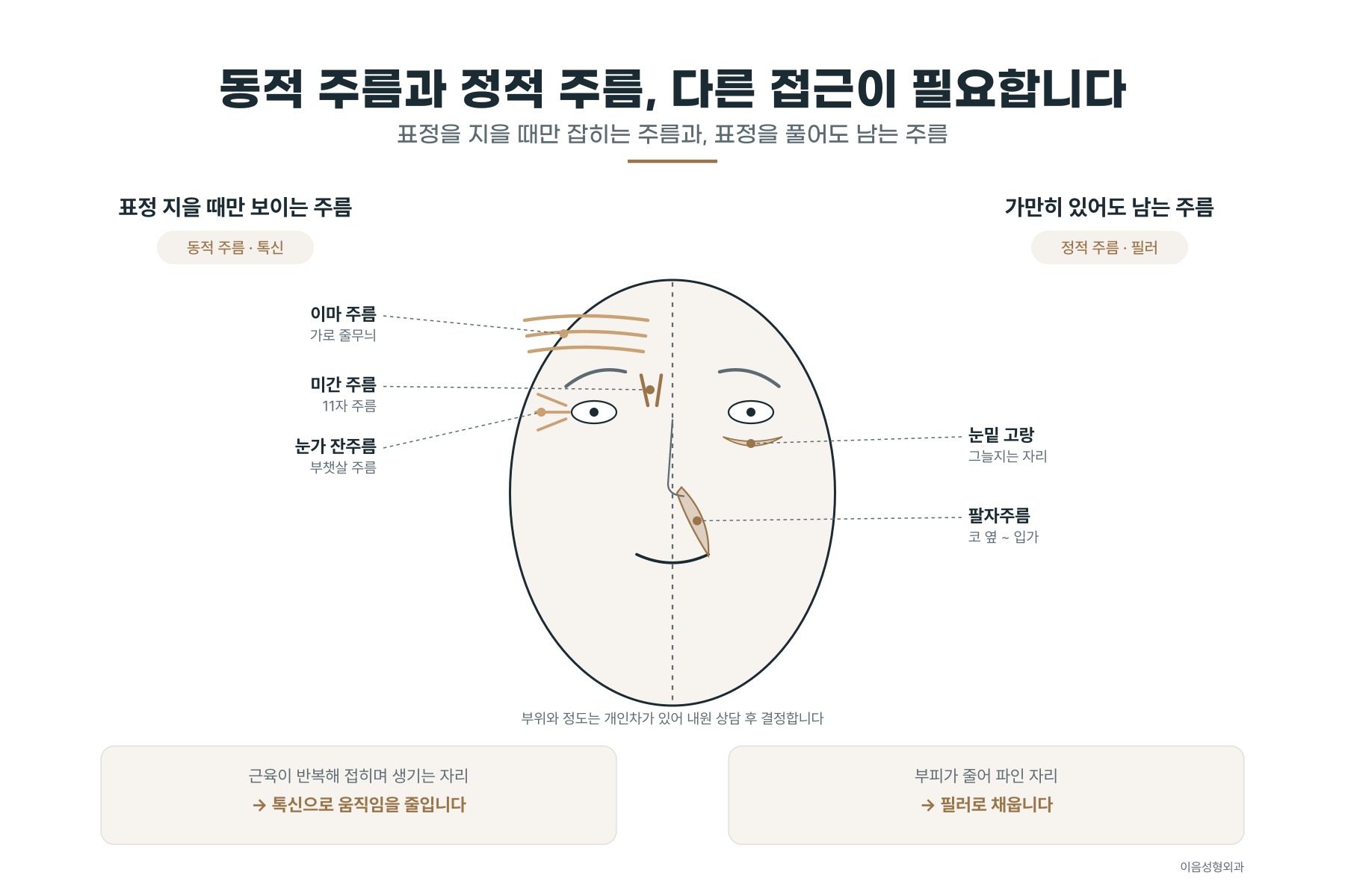 표정 지을 때만 잡히는 주름과 표정을 풀어도 남는 주름