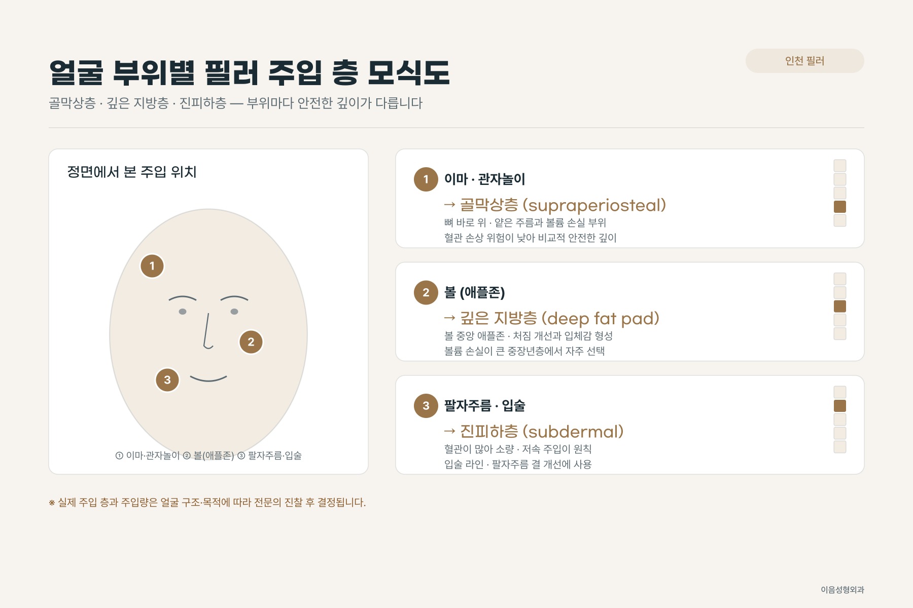 얼굴 부위별 필러 주입 층 모식도 — 골막상층·깊은 지방층·진피하층