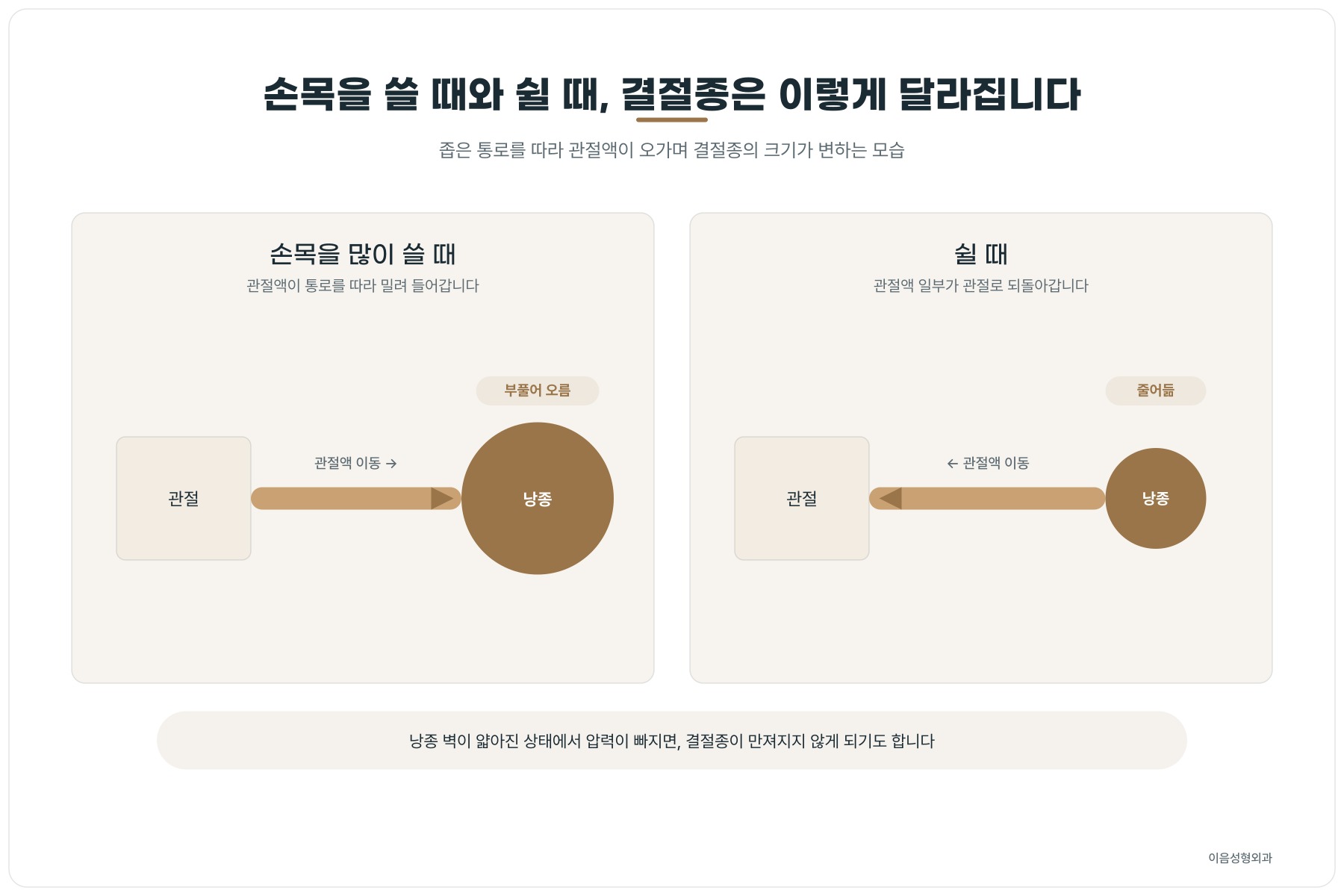 좁은 통로를 따라 관절액이 오가며 결절종의 크기가 변하는 모습