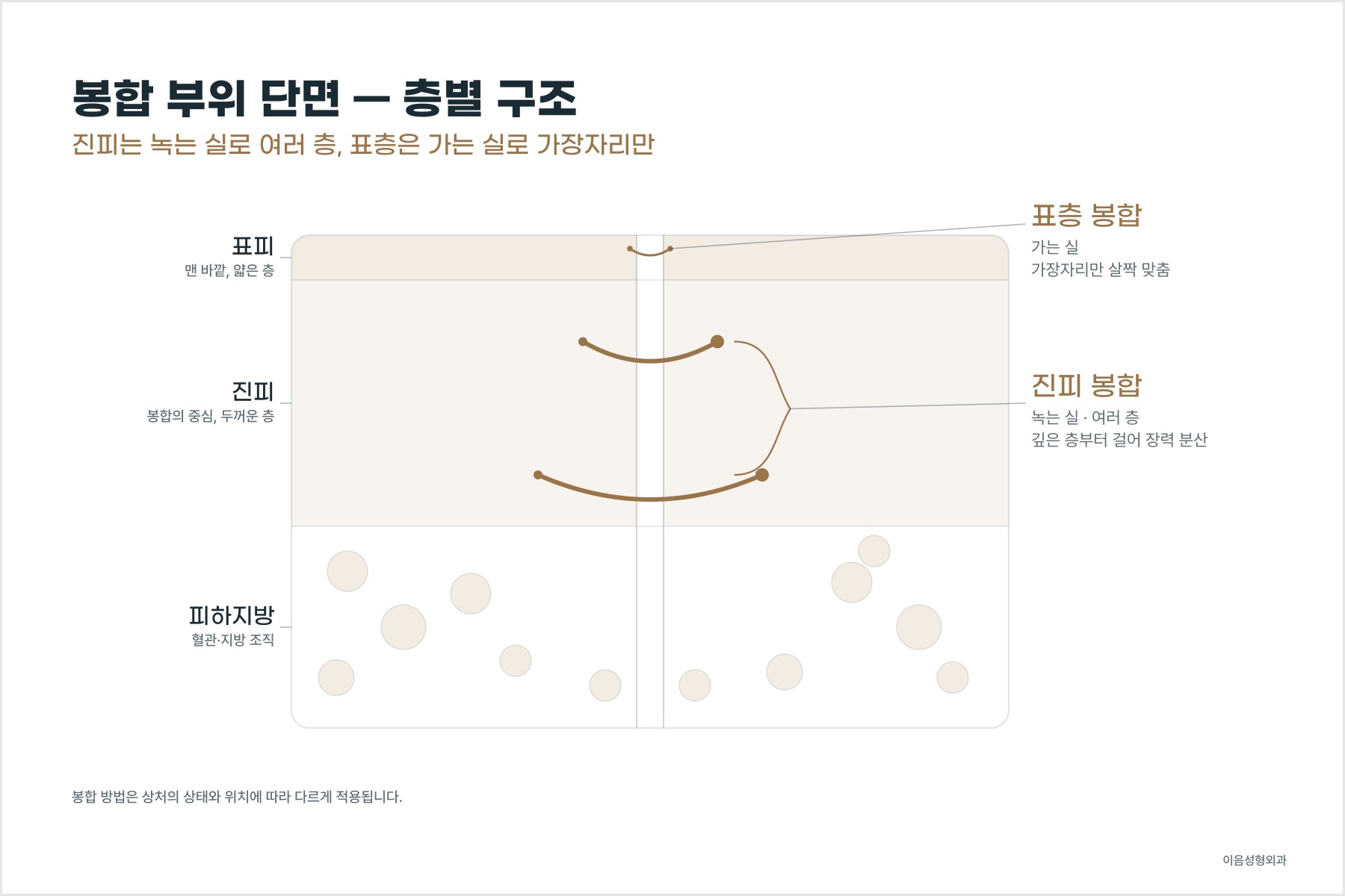 진피 봉합과 표층 봉합의 층별 구조 모식도