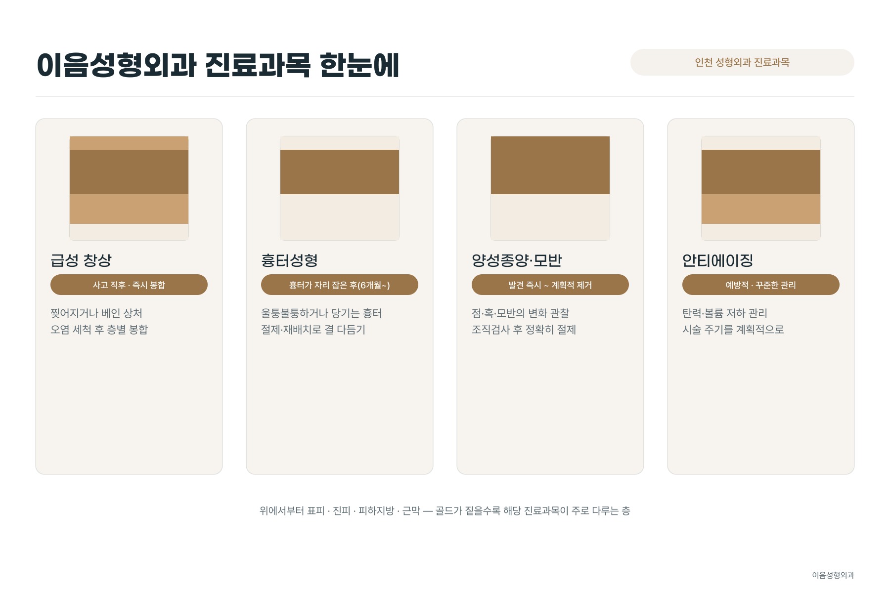 급성 창상, 흉터성형, 양성종양·모반, 안티에이징 네 영역이 각각 다루는 피부 층과 시점을 정리한 도표