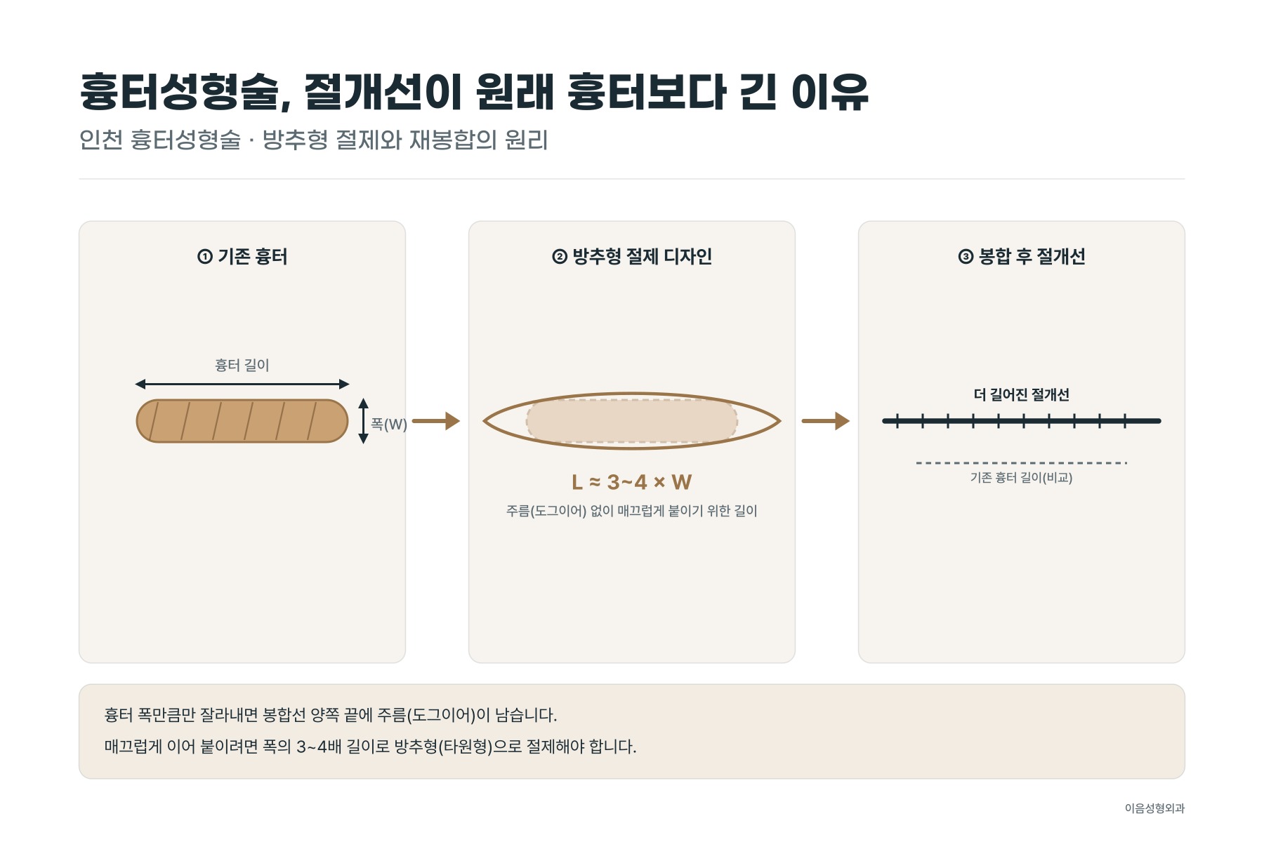 넓은 흉터를 절제해 다시 봉합할 때 절개선이 원래 흉터보다 길어지는 이유를 보여주는 모식도