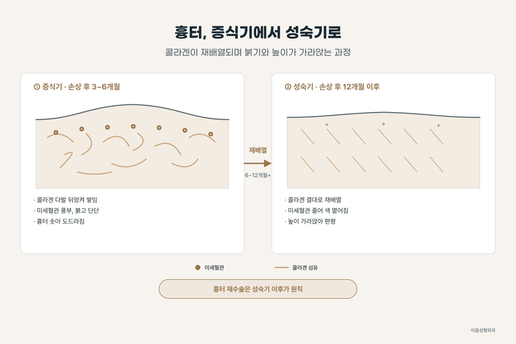 염증기 → 증식기 → 재형성기, 흉터가 붉었다가 가라앉는 시간표