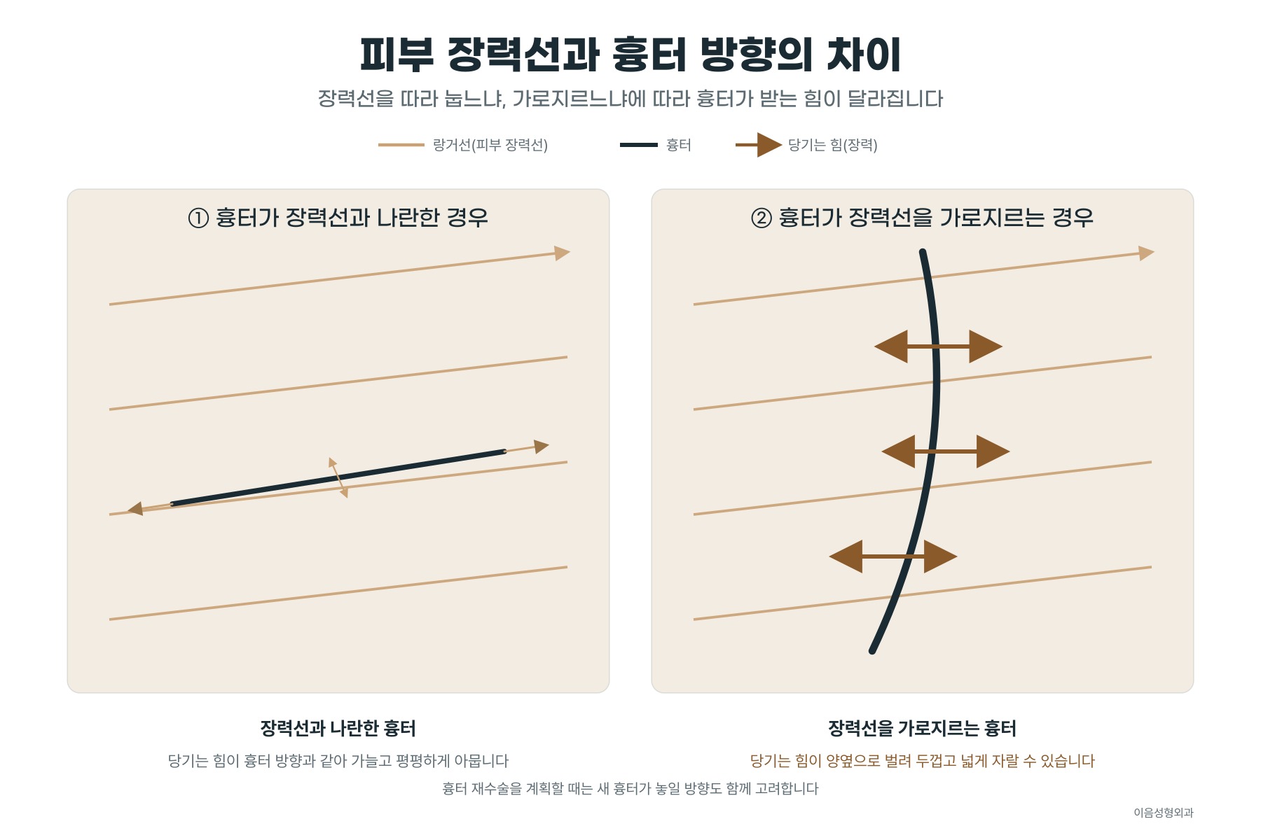 당기는 흉터, 어긋난 흉터, 되풀이되는 흉터 — 기다리지 않는 세 부류