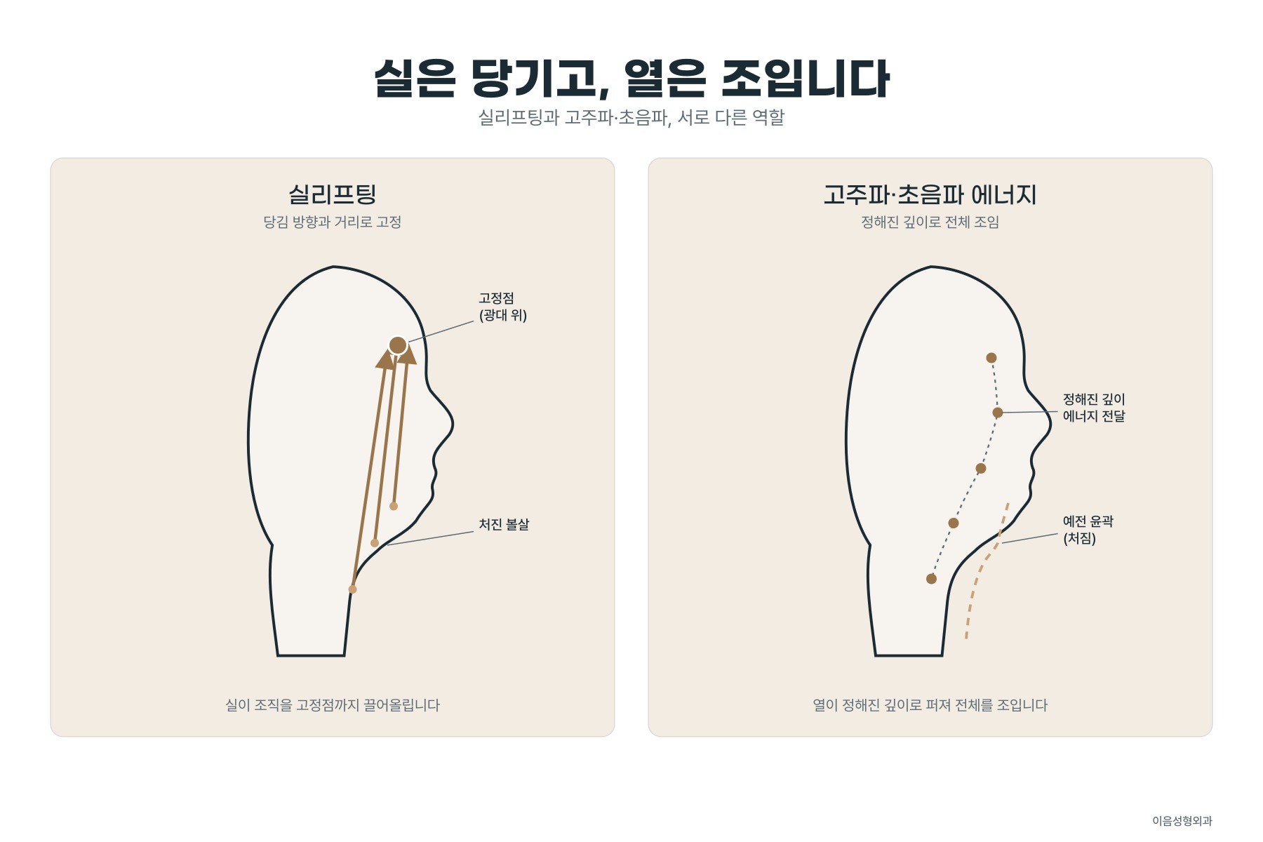 방향을 정해 옮기는 실과 열로 조여지는 에너지 장비