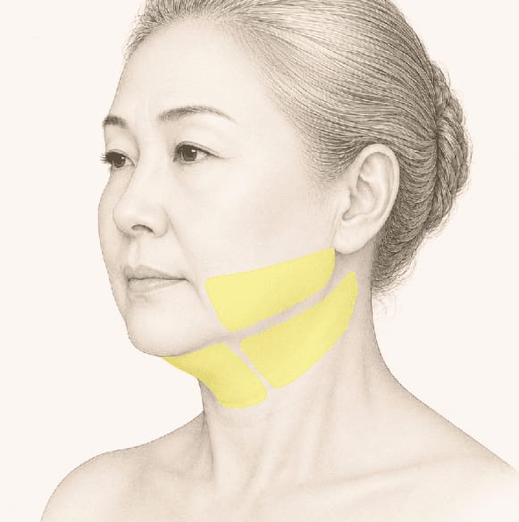부위별 지방 분포